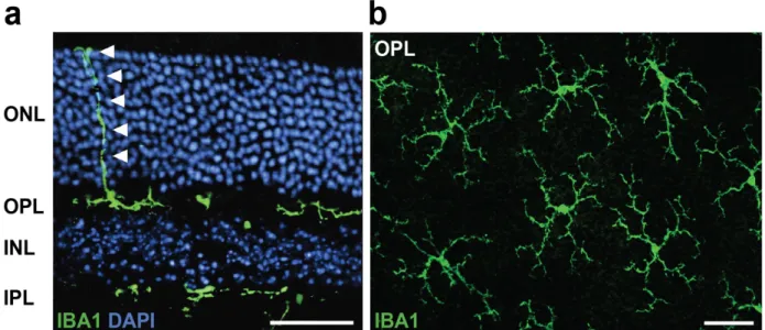 Figure 6: Localization and morphology of microglia in the mature retina. a Immunohistochemical analysis of  Iba1 +  microglia in retinal cross sections shows the distribution of ramified cells throughout the plexiform layers (OPL,  IPL) of the healthy reti