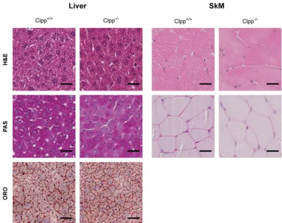 Figure 3.9 Loss of CLPP decreases glycogen content in liver and SkM. 