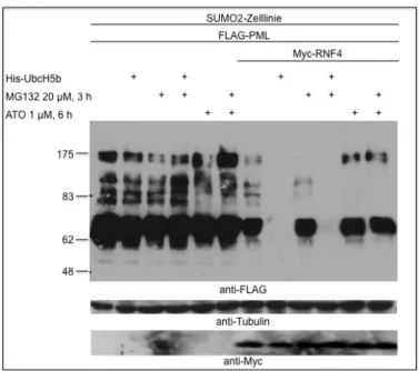 Abb. 3.5:   RNF4  und  UbcH5b  sind  gemeinsam  am  Abbau  von  überexprimiertem  PML beteiligt 