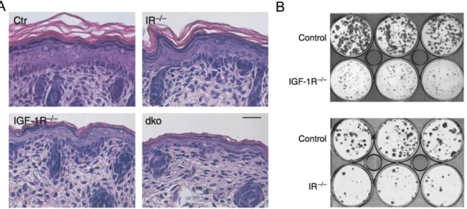 Figure  8:  IIS  regulates  epidermal  thickness  and  proliferative  potential.  (A) H&amp;E staining of ctr, 