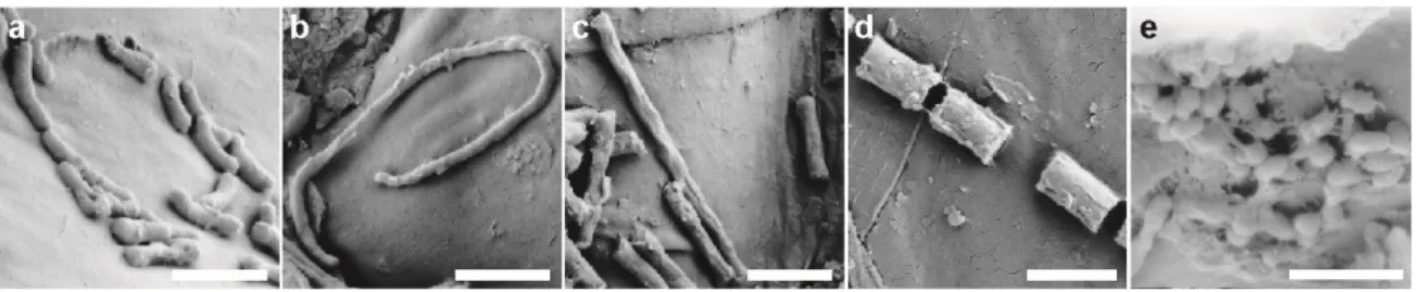 Figure 13: (a to e) Scanning electron micrographs of bacteria-like structures on the rhizoplane