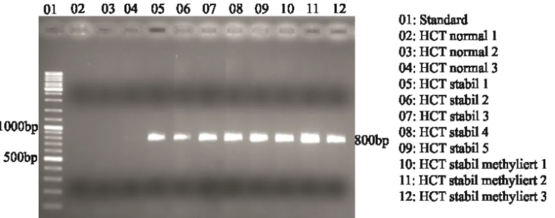 Abbildung 9: PCR mit genomischer DNA isoliert aus Einzelzellklonen mit und ohne integriertes Plasmid 