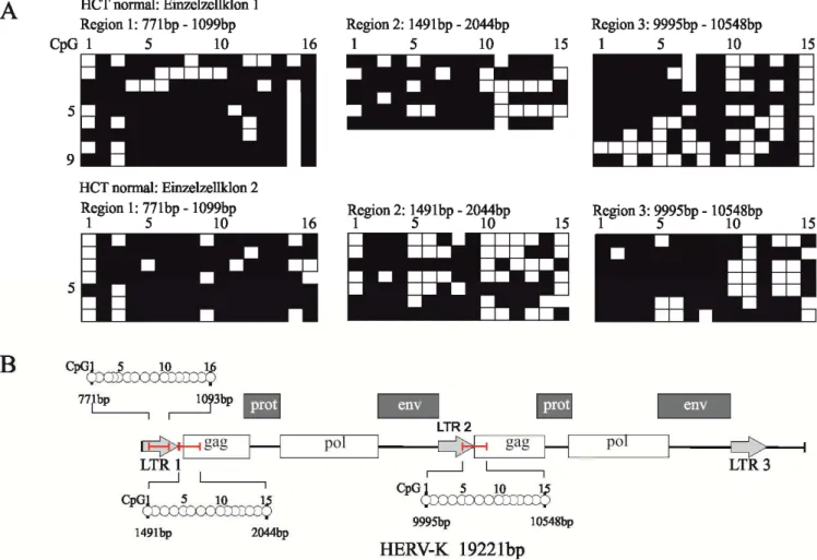 Abbildung 11: HERV- K: Methylierungsmuster von nicht- transfizierten HCT- 116 Einzelzellklonen  A)  Methylierungsmuster der drei Regionen von zwei Kontroll- Einzelzellklonen 