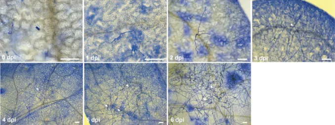 Figure 1: Powdery mildew disease progression on Arabidopsis seedlings. Microscopic images of powdery mildew disease  progression on Col-0 plants