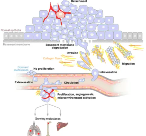 Figure 2: Principal steps of melanoma invasion and metastases formation. Upon transformation from  normal  cells  into  an  invasive  cancer,  cells  first  loose  adherens  junctions  and  detach  from  the  surrounding  cells