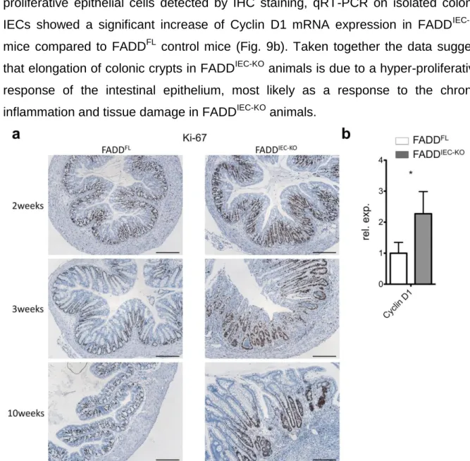 Figure 9 Increased proliferation of epithelial cells in the colon 