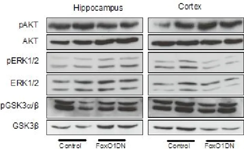 Figure 16: IR/IGF1R signaling pathway of 28 weeks old FoxO1DN mice. 