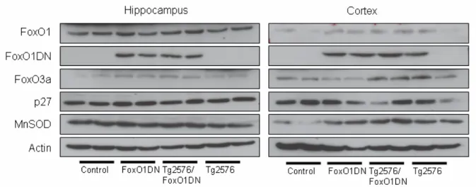Figure 37: Expression of FoxO1 and FoxO3a in Tg2576/FoxO1DN mice. 