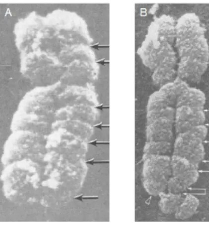 Abbildung  5:  Elektronenmikroskopische   Aufnahme   eines   normalen   und   fragilen   X-Chromosoms