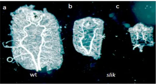 Figure 17:  slik 1  mutant larvae show tube defects within the dorsal trunk  