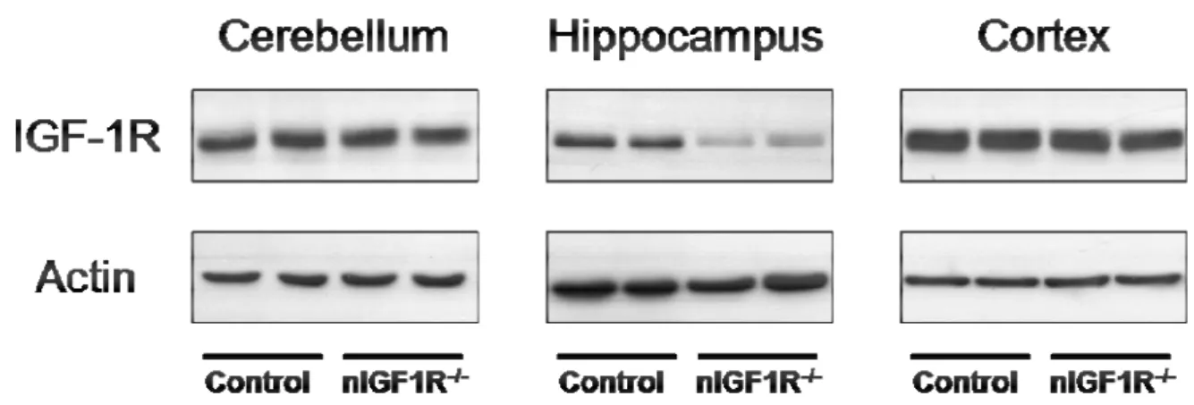 Fig. 3-5  Western blot analysis of IGF-1R protein expression in different brain regions