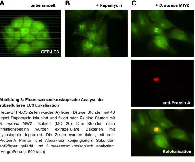 Abbildung 3: Fluoreszenzmikroskopische Analyse der  subzellulären LC3 Lokalisation 