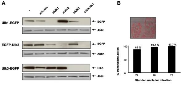 Abbildung 4: Analyse der spezifischen Inhibition der Ulk1, Ulk2 und Ulk3 Expression durch siRNA  A) HeLa Zellen wurden mit 30 nM siRNA und 500 ng Ulk1-EGFP, 750 ng EGFP-Ulk2 oder 250 ng Ulk3-EGFP  Konstrukt transfiziert