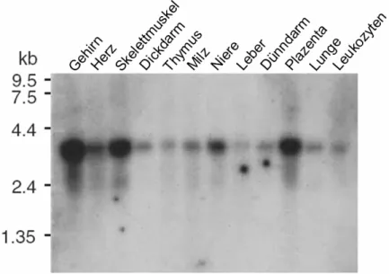 Abb. 3.4: Expressionsanalyse von ATP13A2 mit der Human multiple-tissue RNA Membran. Das Gen  wird ubiquitär in allen untersuchten Geweben als 3,8 kb großes Transkript exprimiert