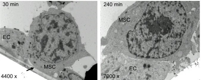 Figure 13:  Electron micrographs of in vitro co-cultivation 