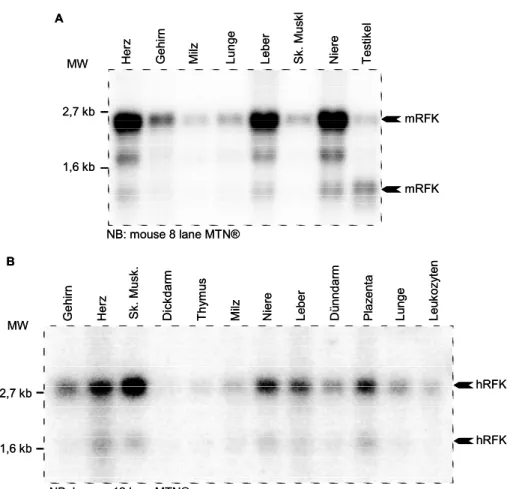 Abb. 3) Expressionsmuster der putativen RFK. Das murine bzw humane ORF der  putativen RFK wurde PCR amplifiziert und als radioaktiv markierte Sonde auf Organ Northern  Blots (MTN ® ; Clontech) oder Zelllinien Northern Blots hybrisisiert