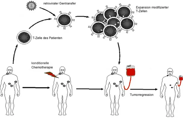 Abbildung  2:   Das   Prinzip   der   adoptiven   Immuntherapie   im   Überblick.  T-Zellen   aus Tumorpatienten soll mittels retroviralem Gentransfer eine Spezifität gegen autologe Tumorzellen verliehen   werden