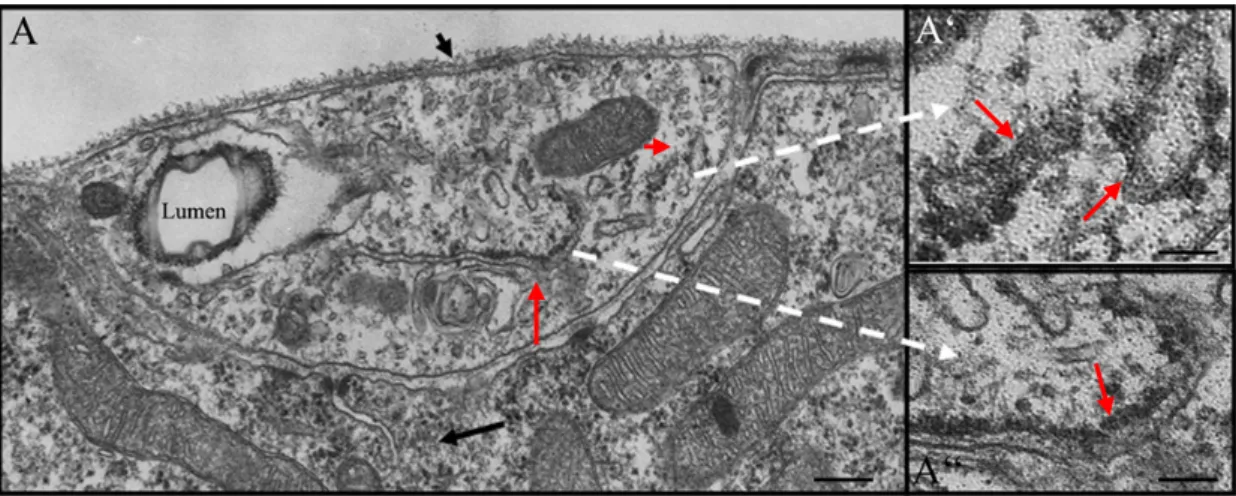 Figure 15. Electron micrograph of a section through Type-B terminal branch. A, The lumen in the  section is hollow cavity towards a side of the section