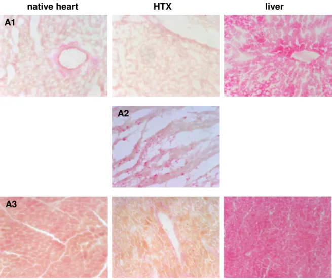 Figure  13:  X-Gal  and  eosin  stained  tissue  sections  of  rats  receiving  vector  into  the  transplanted  heart  at  normothermia