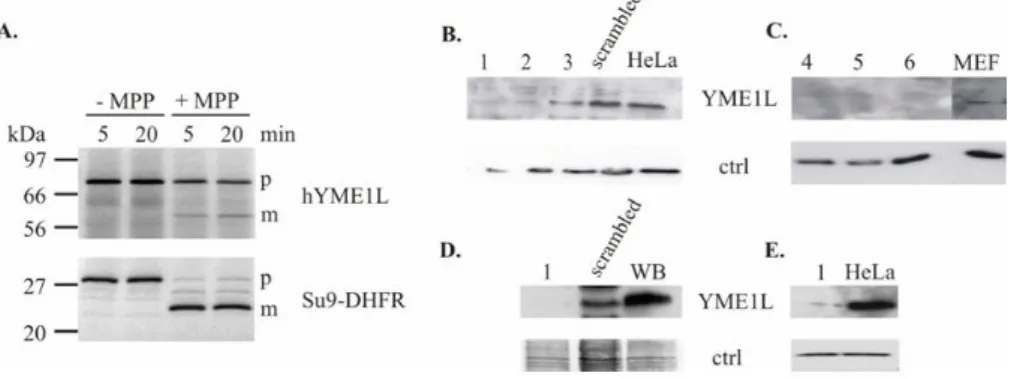 Figure 3.1: Recognition of the mature YME1L by different antibodies used in the present work