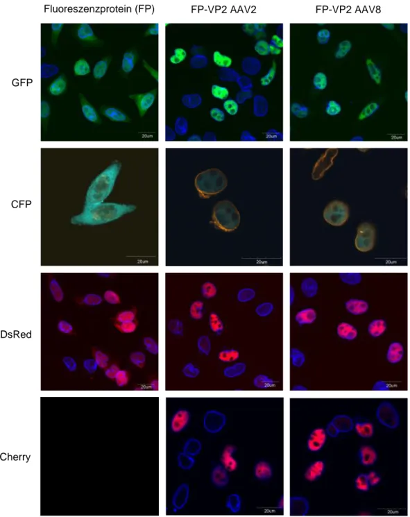 Abb.  3-2:  Transiente  Transfektion  von  HeLa-Zellen  mit  Fluoreszenzprotein  (FP)  und  FP-VP2   exprimierenden Plasmiden