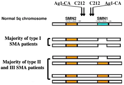 Fig. 3 Schematic representation of the most frequently observed SMA chromosomes in acute SMA  (type  I)  and  mild  SMA  (type  II/III)