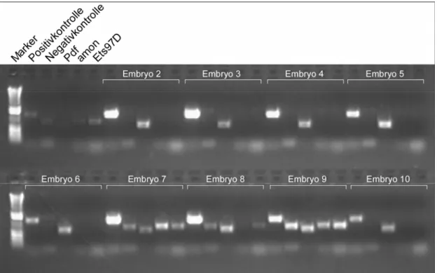 Abbildung 2.6: Single-Embryo-PCR an Df(3R)ro 80b   
