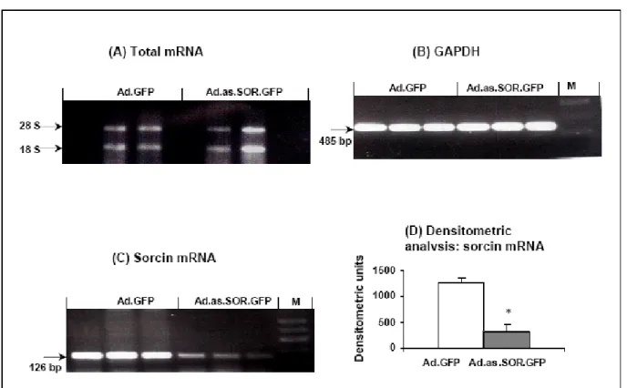 Fig 3.3 RT-PCR to evaluate downregulation of sorcin mRNA  