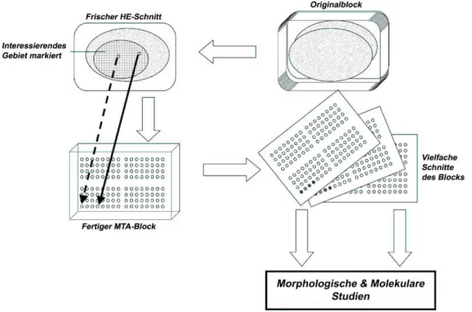 Abbildung 3: Schematische Darstellung zur Herstellung von  multi tissue arrays. Aus paraffi- paraffi-nierten  Gewebeblöcken  werden  mit  Hilfe  einer  Hohlnadel  Zylinder  herausgestanzt,  die  in  einen  neuen  Paraffinblock  überführt  werden