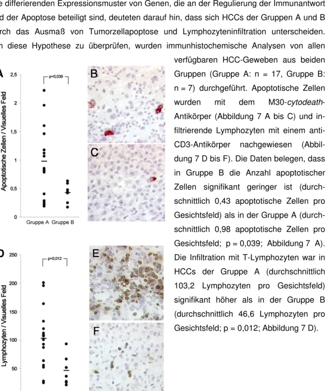 Abbildung 7: Immunhistologische Untersuchung der HCCs. A: Statistische Auswertung der  M30-Färbung durch Auszählung positiv gefärbter Zellen in der maximalen Anzahl von  visuel-len  Feldern  pro  Gewebeschnitt