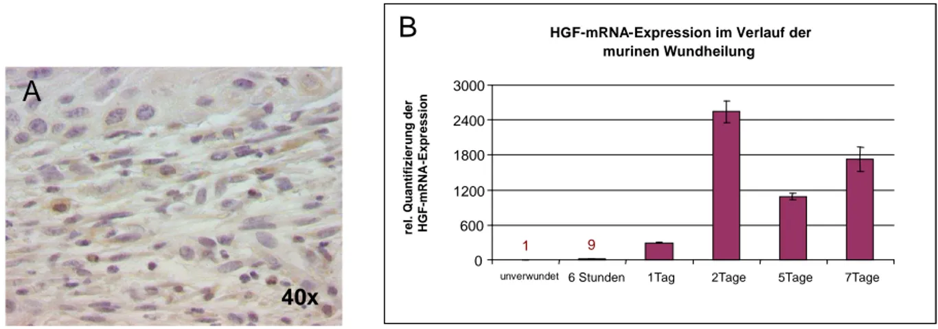 Abbildung 7: Nachweis von HGF in unverwundeter und verwundeter muriner Haut  Die  Proteinexpression  von  HGF  wurde  exemplarisch  am  vierten  Tag  nach  Verwundung  immunhistochemisch nachgewiesen (A)