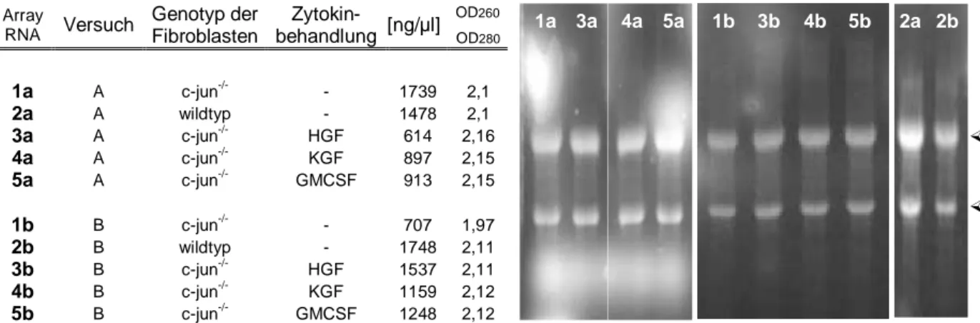 Abbildung 13: Photometrische Quantifizierung und Qualitätskontrolle der drei Stunden  nach Zytokinbehandlung isolierten Gesamt-RNA auf einem 1%igem RNA Gel 
