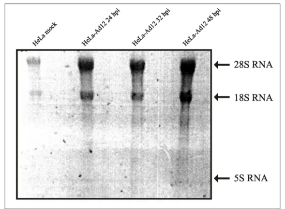 Abbildung 4.2: RNA aufgetrennt auf einem 1 %-igen Agarosegel.