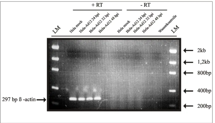 Abbildung 4.3: Kontrollexperimente durch RT-PCR unterschiedlicher HeLa-RNA Präparationen : Scheininfektion, 24 h p.i., 32 h p.i