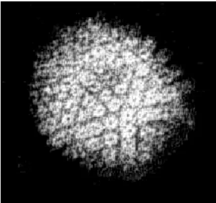 Abb. 1: Elektronenmikroskopische Aufnahme eines Herpes simplex Virus. Abbildung  entliehen von: 