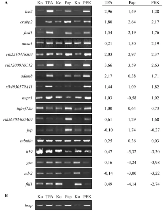 Abb. 4: Verifizierung der Ergebnisse aus der Microarray-Analyse durch semi-quantitative RT- RT-PCR