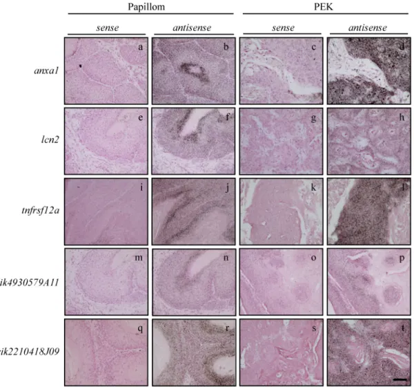 Abb. 5: Erhöhte Expression von anxa1,  lcn2,  tnfrsf12a,  rik4930579A11 und rik2210418J09 in  den Keratinozyten muriner Hauttumoren