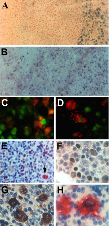 Abbildung 3. Lokalisation und phänotypische Charakterisierung EBV-infizierter Zellen