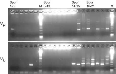 Abbildung 5. Agarosegelphoto von PCR-Produkten einer V H - und einer V l -PCR