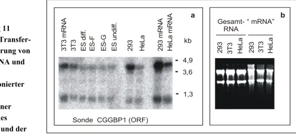 Abbildung 11  Northern-Transfer-Hybridisierung von Gesamt-RNA und  Poly-A-vorselektionierter mRNA verschiedener Zellinien des Menschen und der Maus.