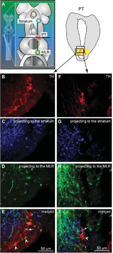 Fig. 2. TH-positive cells projecting to the striatum or to the MLR are intermingled in the PT as shown in triple-labeling experiments
