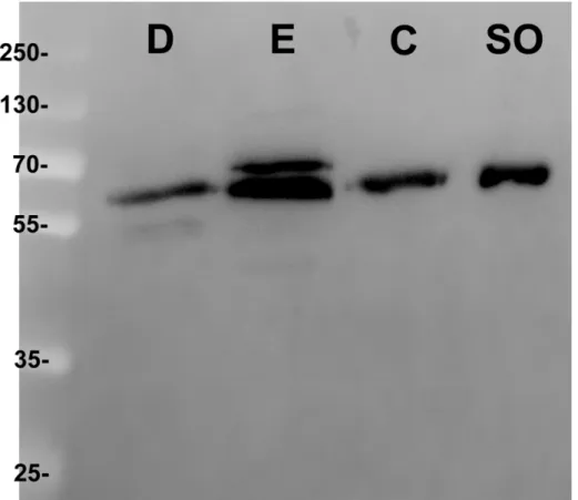 Figure 4. A Western Blot demonstrating the absence of proteolytic activity during the  protein  extraction  protocol  that  was  used  for  the  proteome  study  presented  here