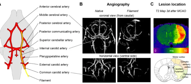 Figure 2: Middle cerebral artery occlusion in rodents      