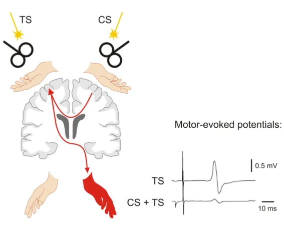 Figure  1.9:  Introduction:  Paired-pulse  transcranial  magnetic  stimulation  (TMS)  applied  to  both  hemispheres