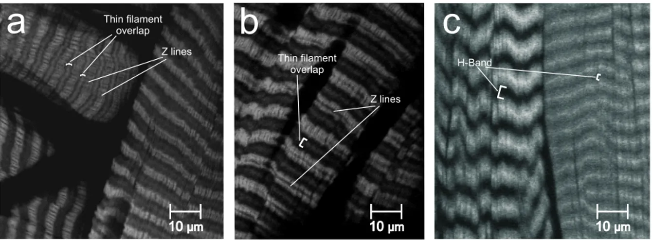Figure C.5: LSM (laser scanning microscope) pictures showing either thin filament overlap (a, b) or occurence of an H-band (c) in extensor and flexor tibiae fibres after phalloidin treatment.