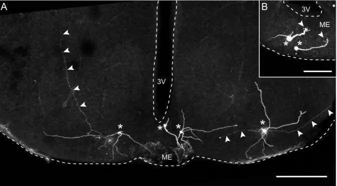 Figure 3.1: Morphology of POMC neurons. (A) Maximum intensity projection of a confocal image stack