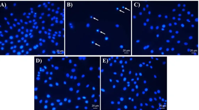 Figure 3: DAPI nuclei staining. Effect of FIII and FIV, NAC and Cisplatin on apoptosis of GRX cells  analyzed by nuclear morphology