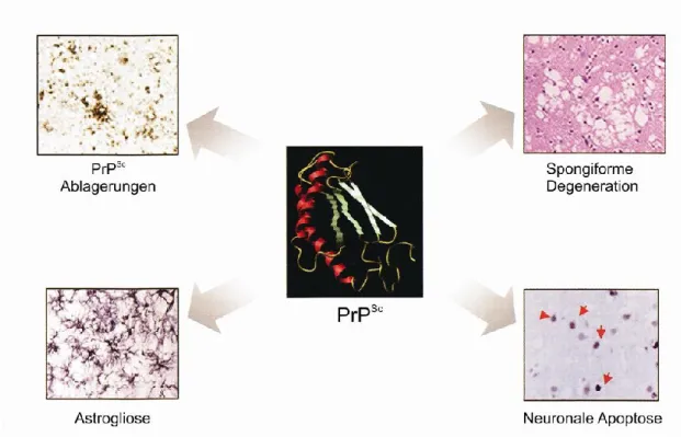 Abbildung 1: Neuropathologische Eigenschaften der TSE. Der zentrale Prozess in der Entstehung der  Prion-Erkrankung ist die Umfaltung von PrP C  in die pathogene Isoform PrP Sc , welches manchmal in Form  von amyloiden Ablagerungen im Gehirn zu finden ist