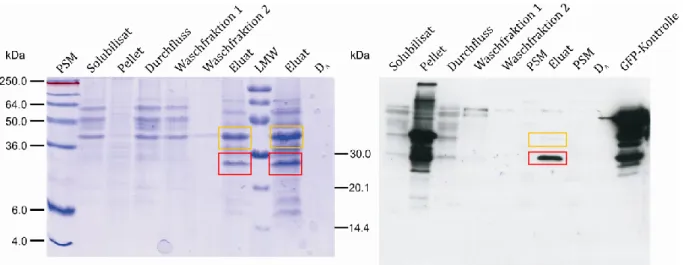 Abbildung  13:  18  %iges  SDS-Polyacrylamidgel  der  nativen  Aufreinigung  von  GFP-GPI  (links)  und  das  Ergebnis  der  anschließenden  WB-Analyse  mit  anti-GFP-Antikörper  (rechts)