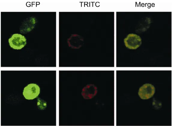 Abbildung 22: Immunofluoreszenzanalyse von GFP-GPI in Hefezellen mit anti-GFP Erstantikörper und  TRITC-konjugiertem Zweitantikörper